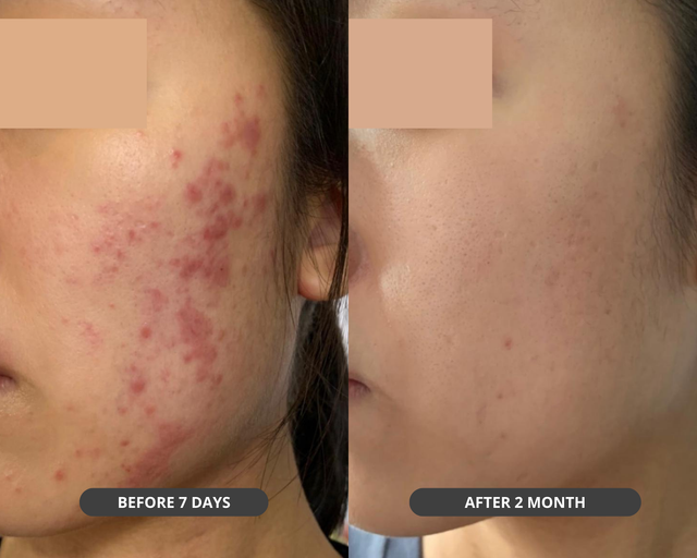Customer result photo