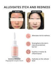 Sensitive Advanced Oligopeptide Serum