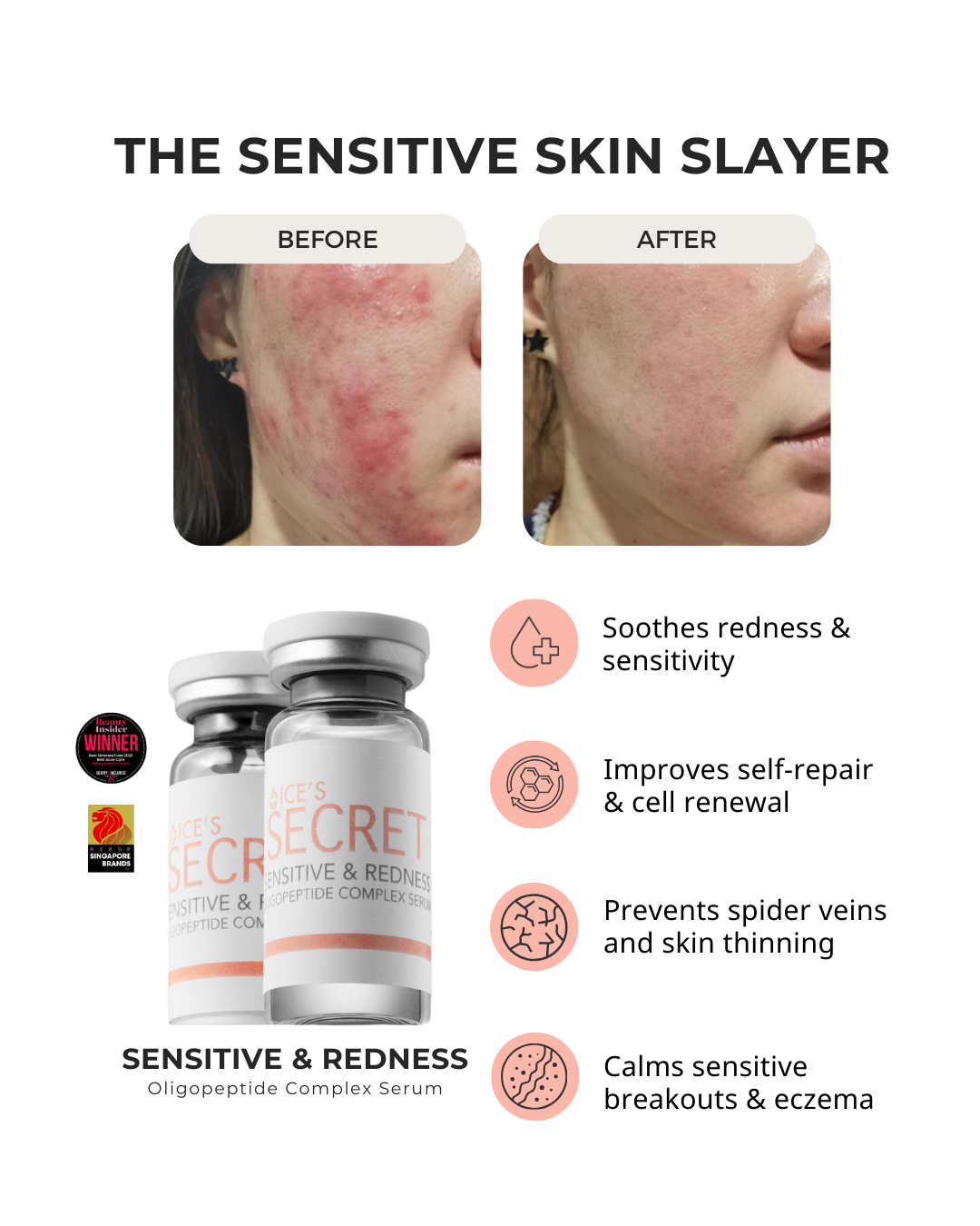 Sensitive SOS Kit