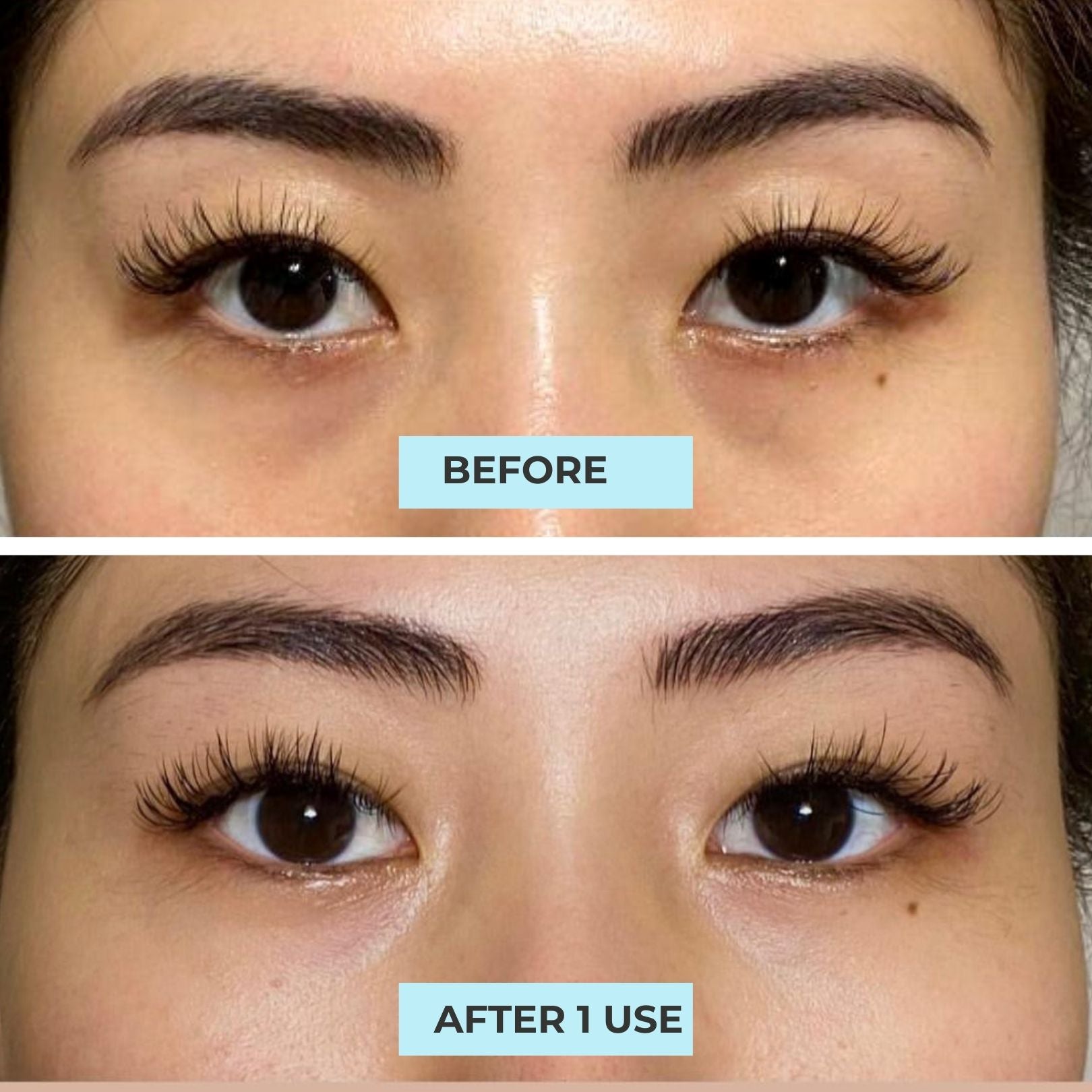 (FLASH SALES) Serum & Eye Mask Kit: Best Eye Serum Advanced + Night Owl Eye Mask III