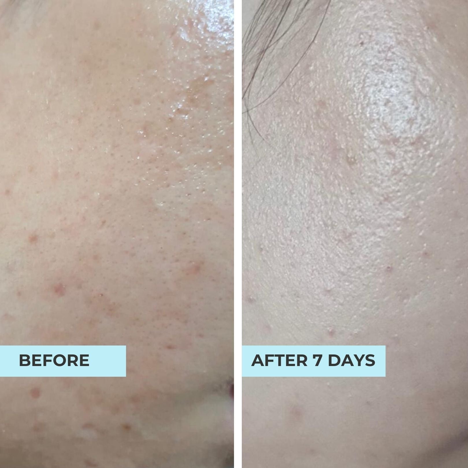 (FLASH SALES) Pore-Perfect Pair: Pore & Glow + O2 Mask