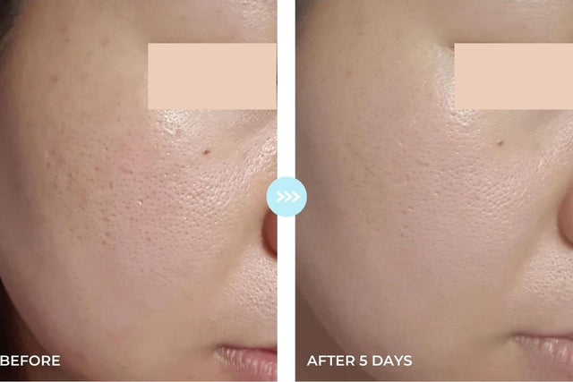 Customer result photo