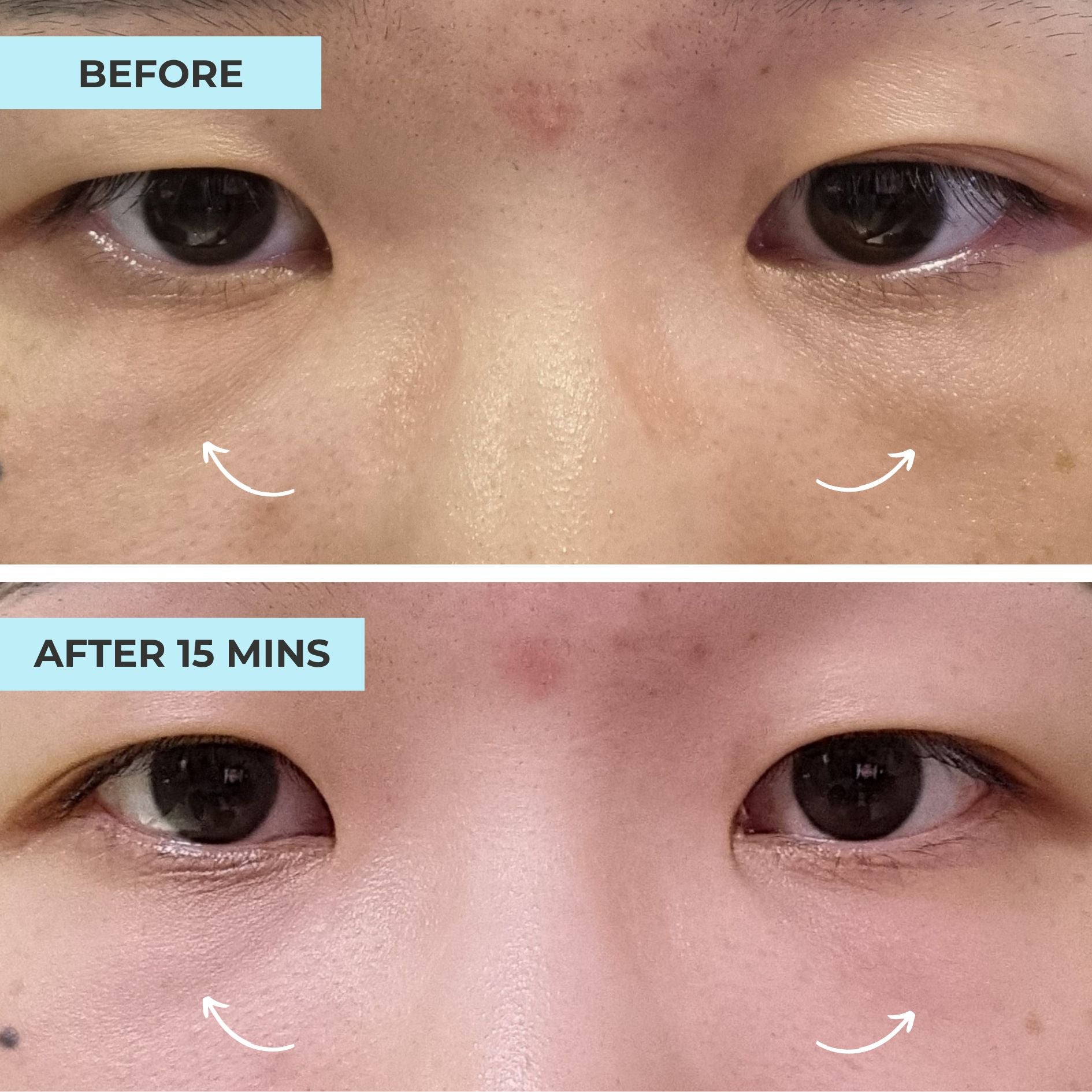 (FLASH SALES) Serum & Eye Mask Kit: Best Eye Serum Advanced + Night Owl Eye Mask III