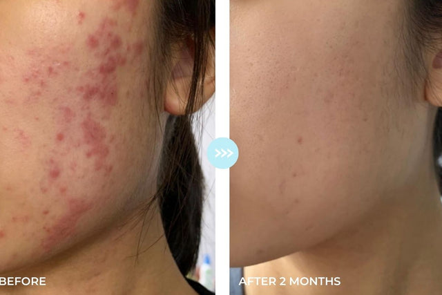 Customer result photo