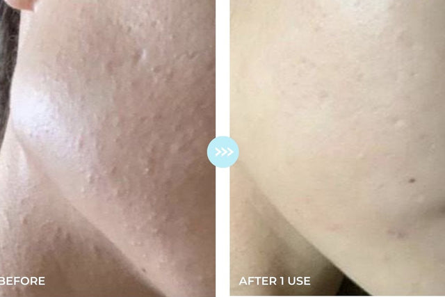 Customer result photo