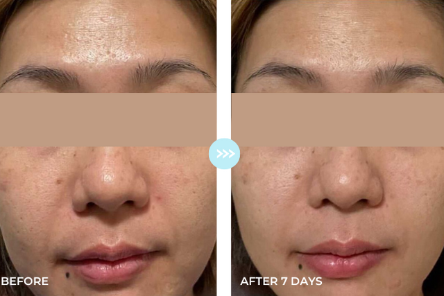 Customer result photo