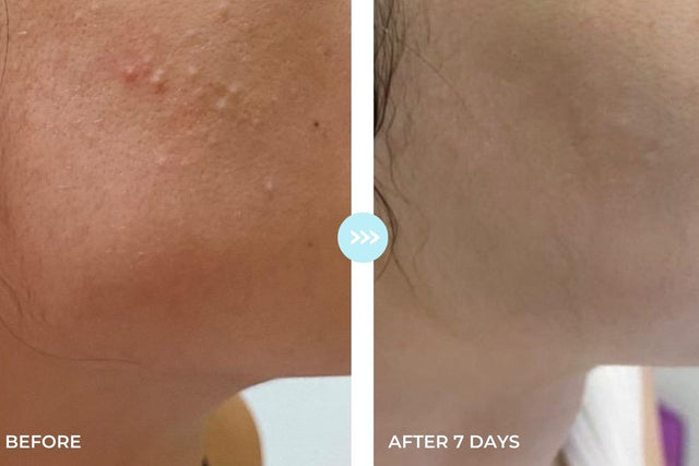 Customer result photo