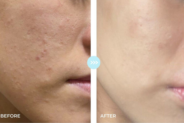Customer result photo