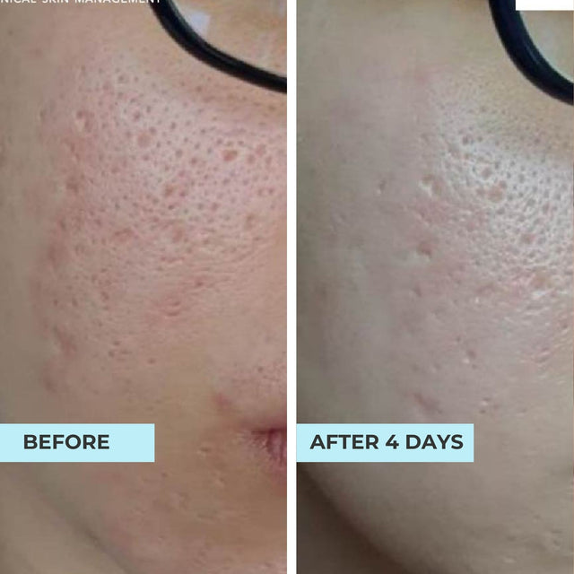 Customer result photo