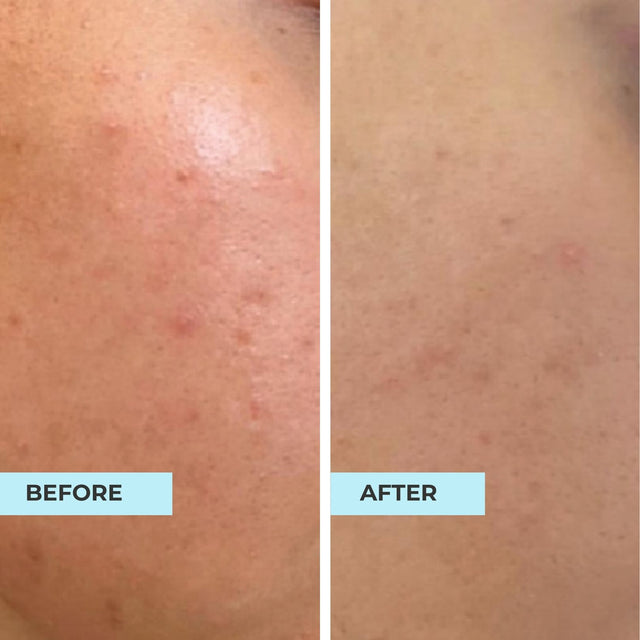 Customer result photo