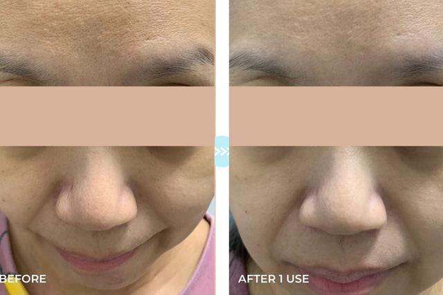 Customer result photo
