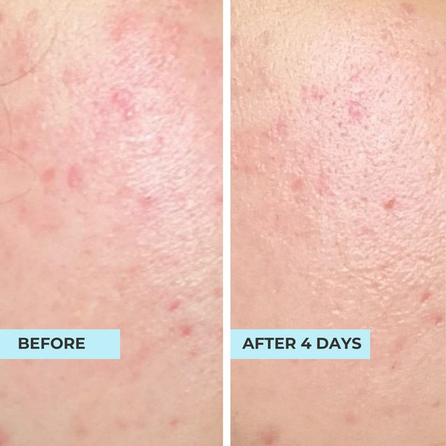 Customer result photo