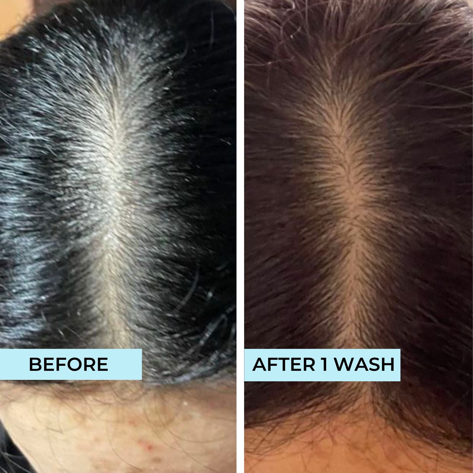 07 Refreshing Anti-Dandruff Shampoo
