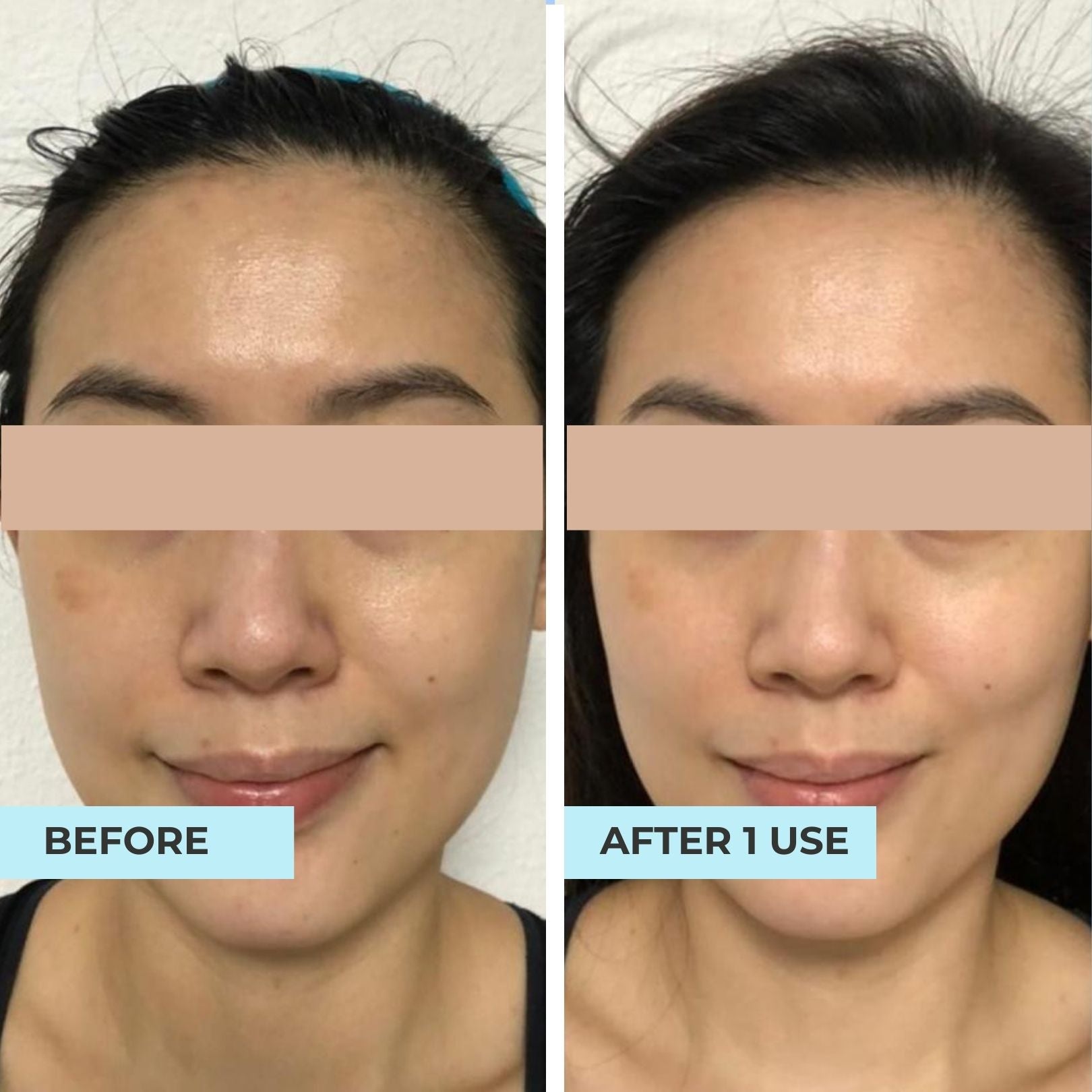 (11.11 FLASH SALES) Illuminating Oligopeptide & Acne Purifying Mask Bundle