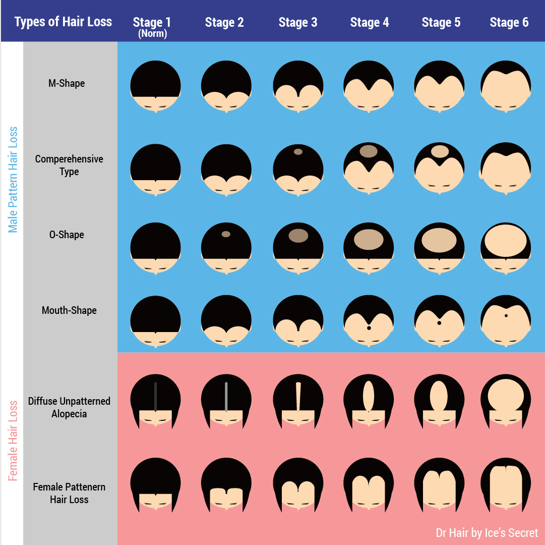 Receding Hairline Tonic