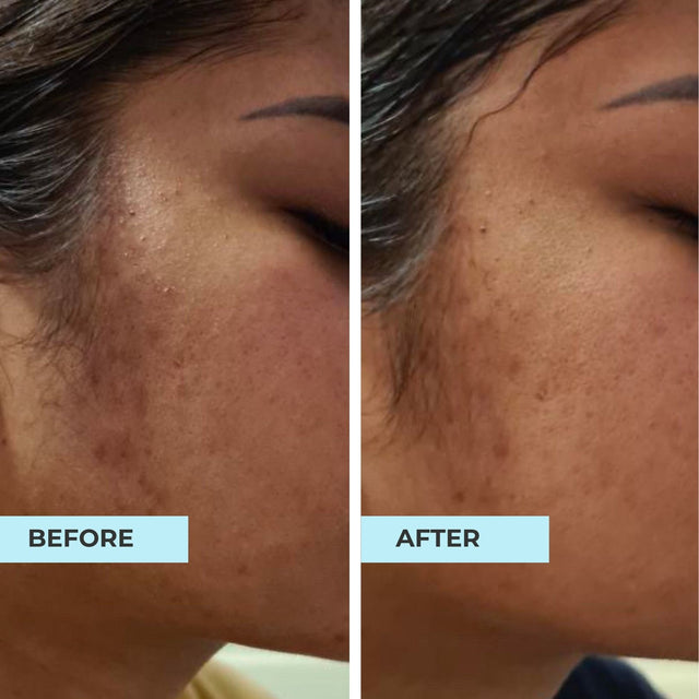 Customer result photo