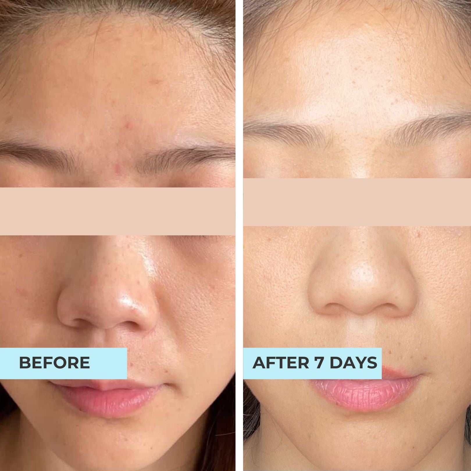 Super Serum: Brightening & Anti-Blemish