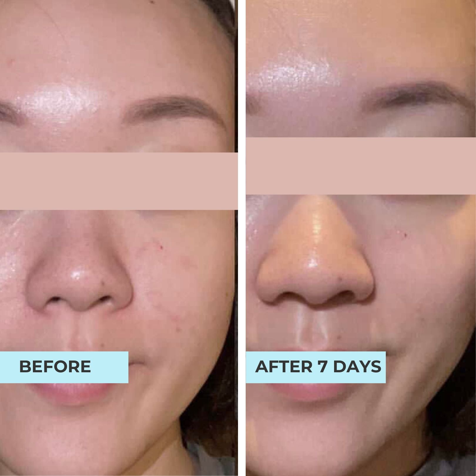 Super Serum: Brightening & Anti-Blemish