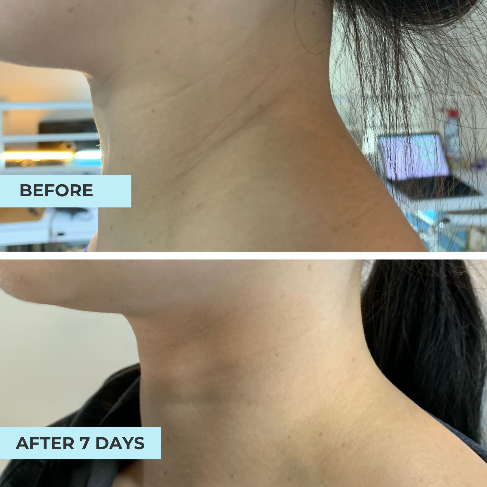 Neck Brighten & Lift Oligopeptide Complex Serum