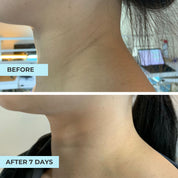 Neck Brighten & Lift Oligopeptide Complex Serum