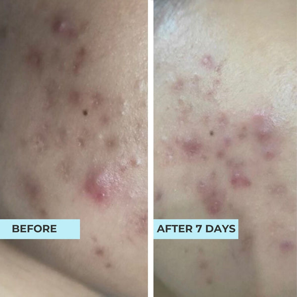 Customer result photo