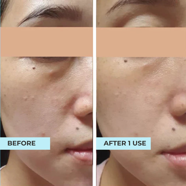 Customer result photo