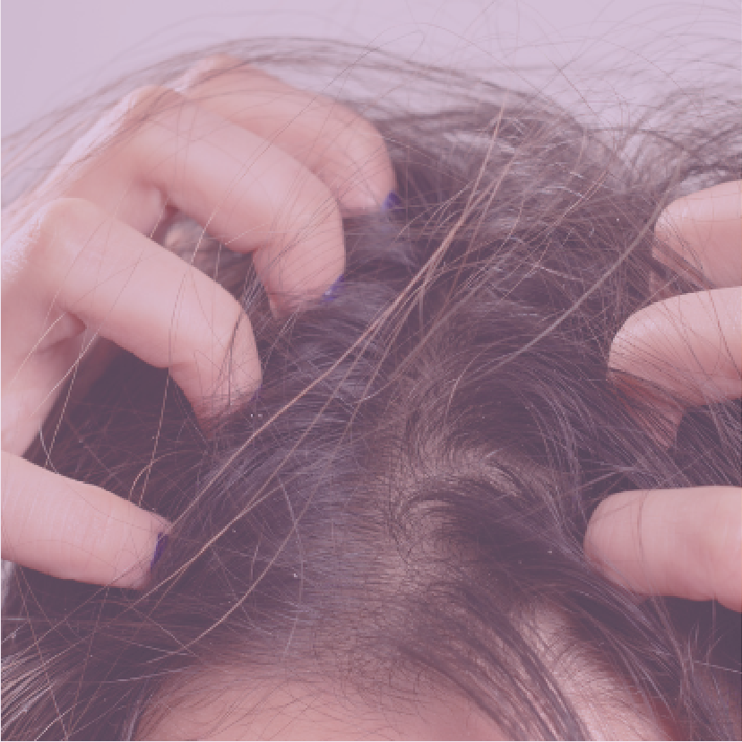 Itchy Scalp