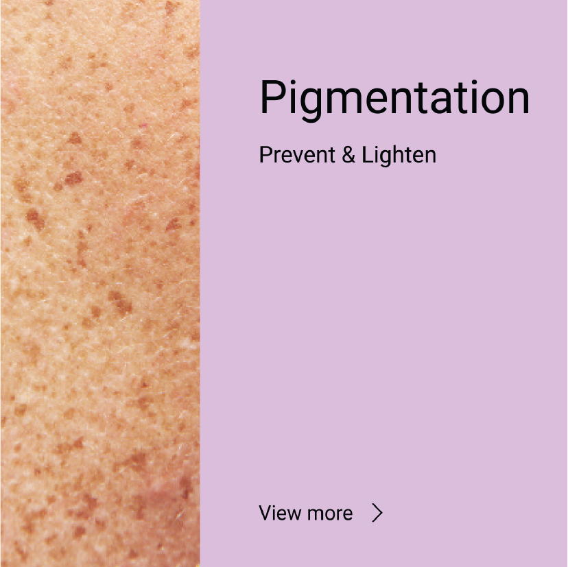 Pigmentation <span>Prevent & Lighten</span>