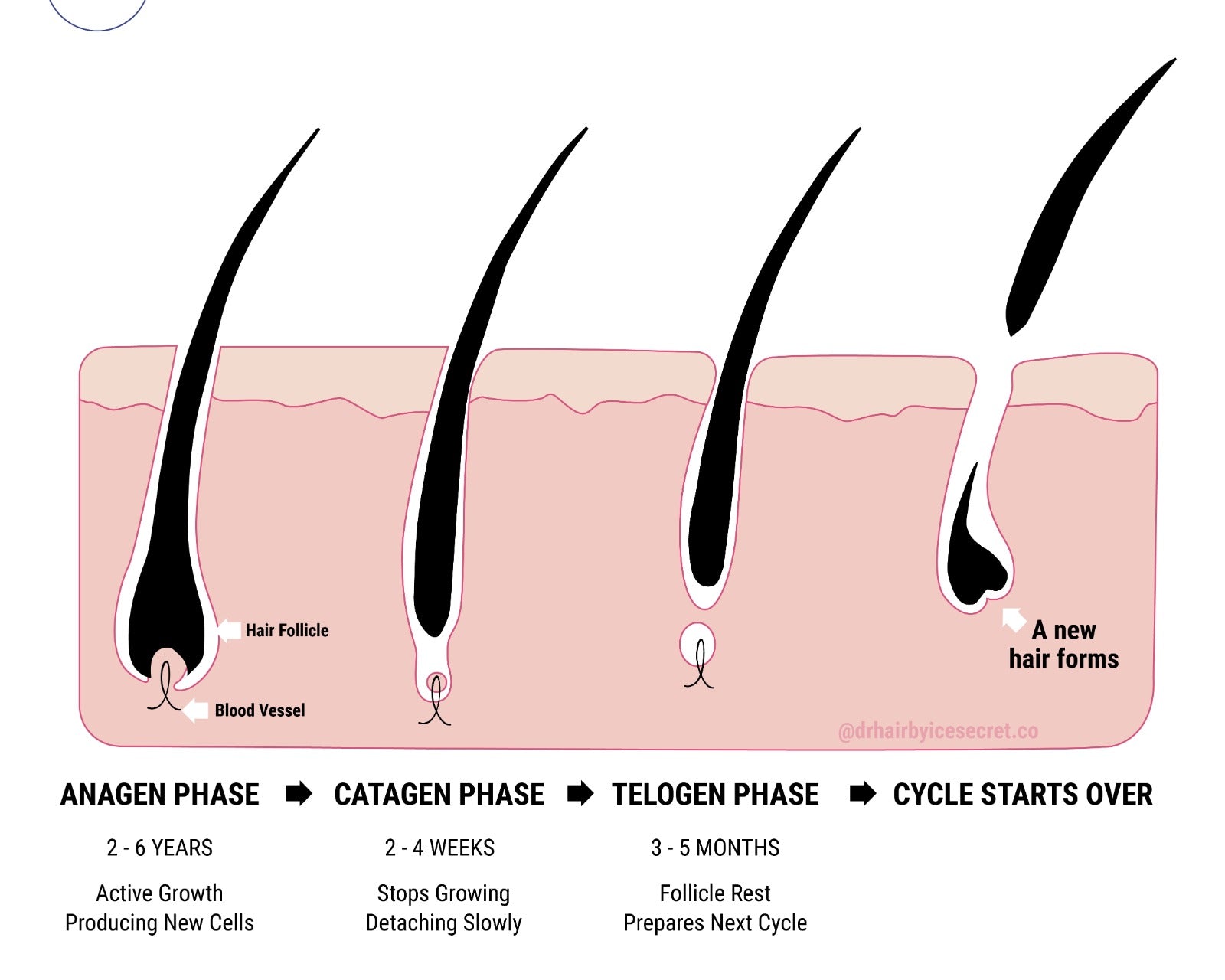 Hair loss - why it happens