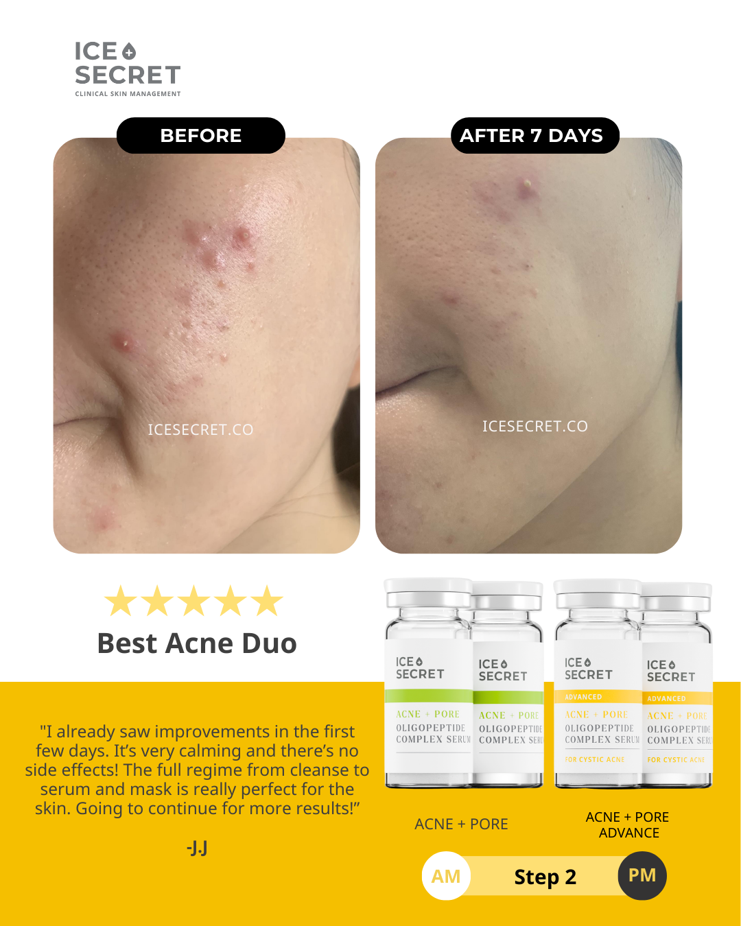 Acne Advance Kit