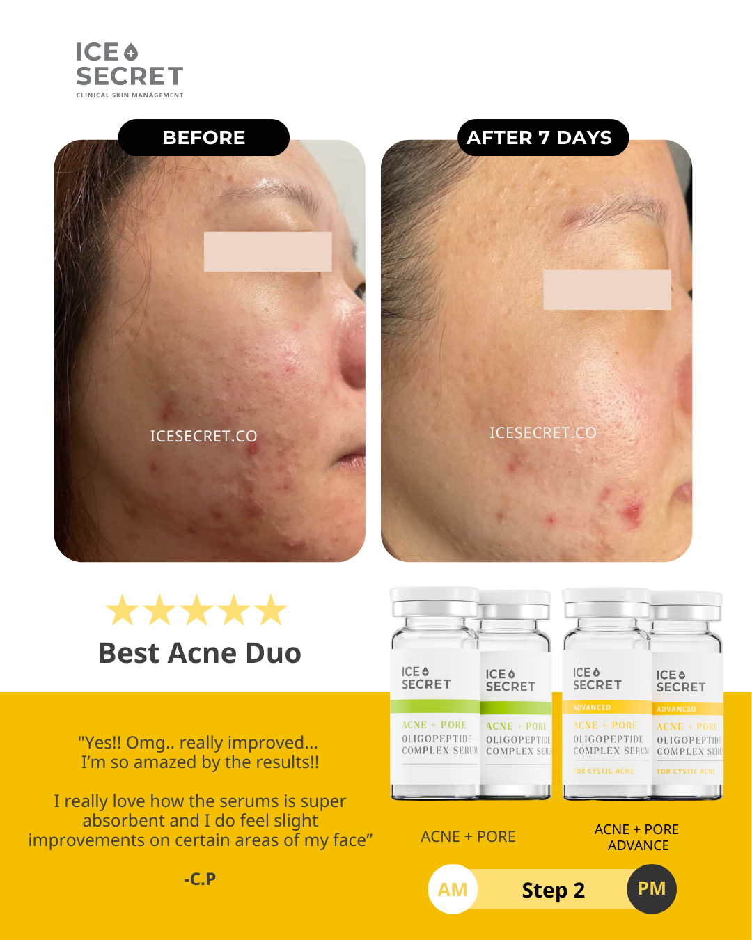 Acne Advance Kit