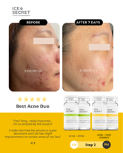 Acne Advance Kit