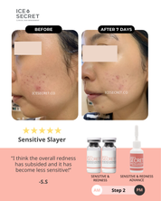 Signature Sensitive Slayer Kit