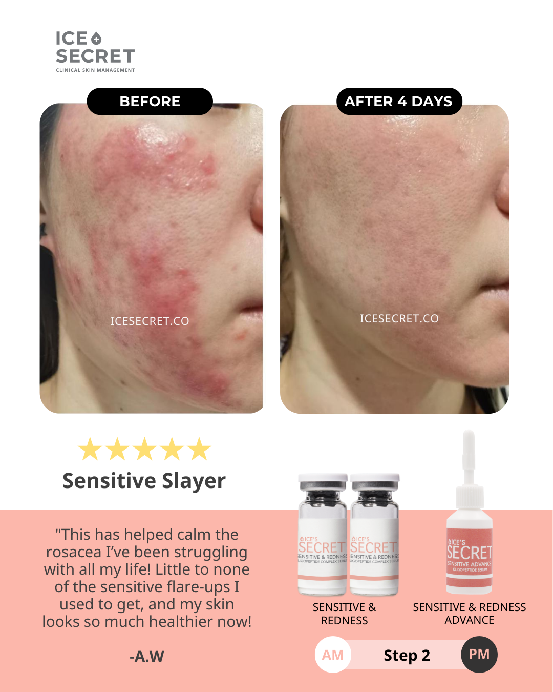 Signature Sensitive Slayer Kit