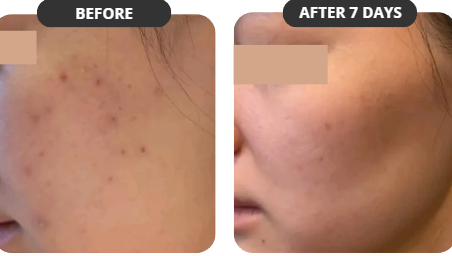 Customer result photo