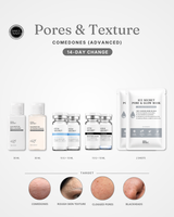 Pores · 14-Day Change (Comedones)