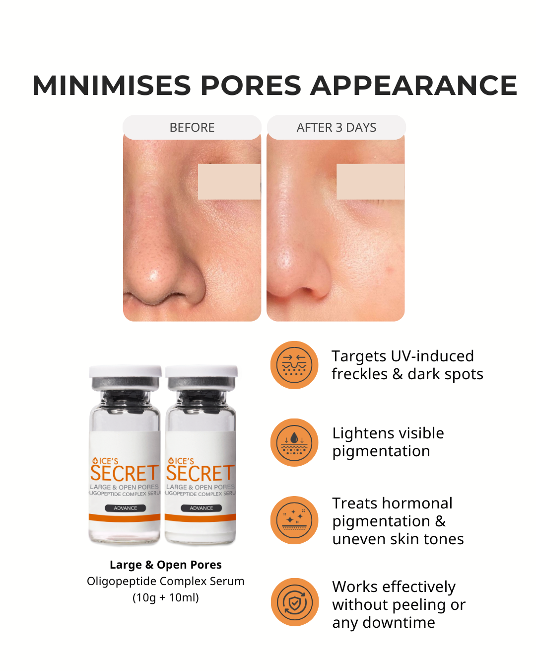 Pore Minimiser Kit (&lt; 30 Years)