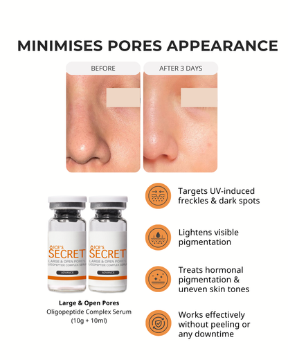 Pore Minimiser Kit (&lt; 30 Years)