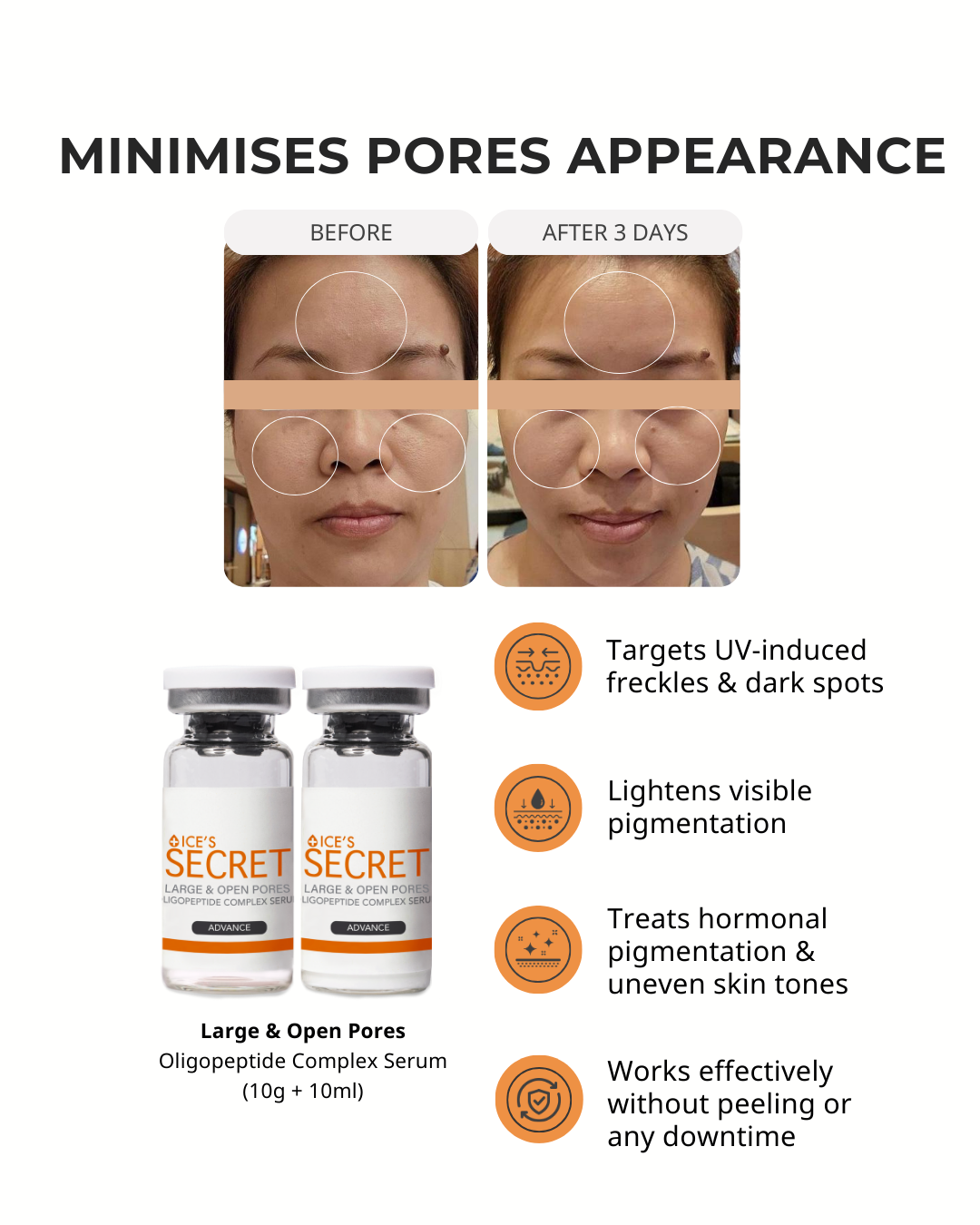Large & Open Pores Oligopeptide Complex Serum