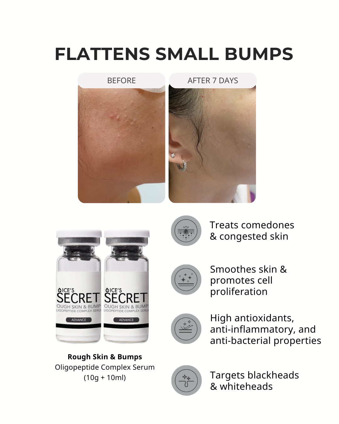 Comedones &amp; Clogged Skin Kit