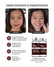 Pigmentation · 14-Day Change