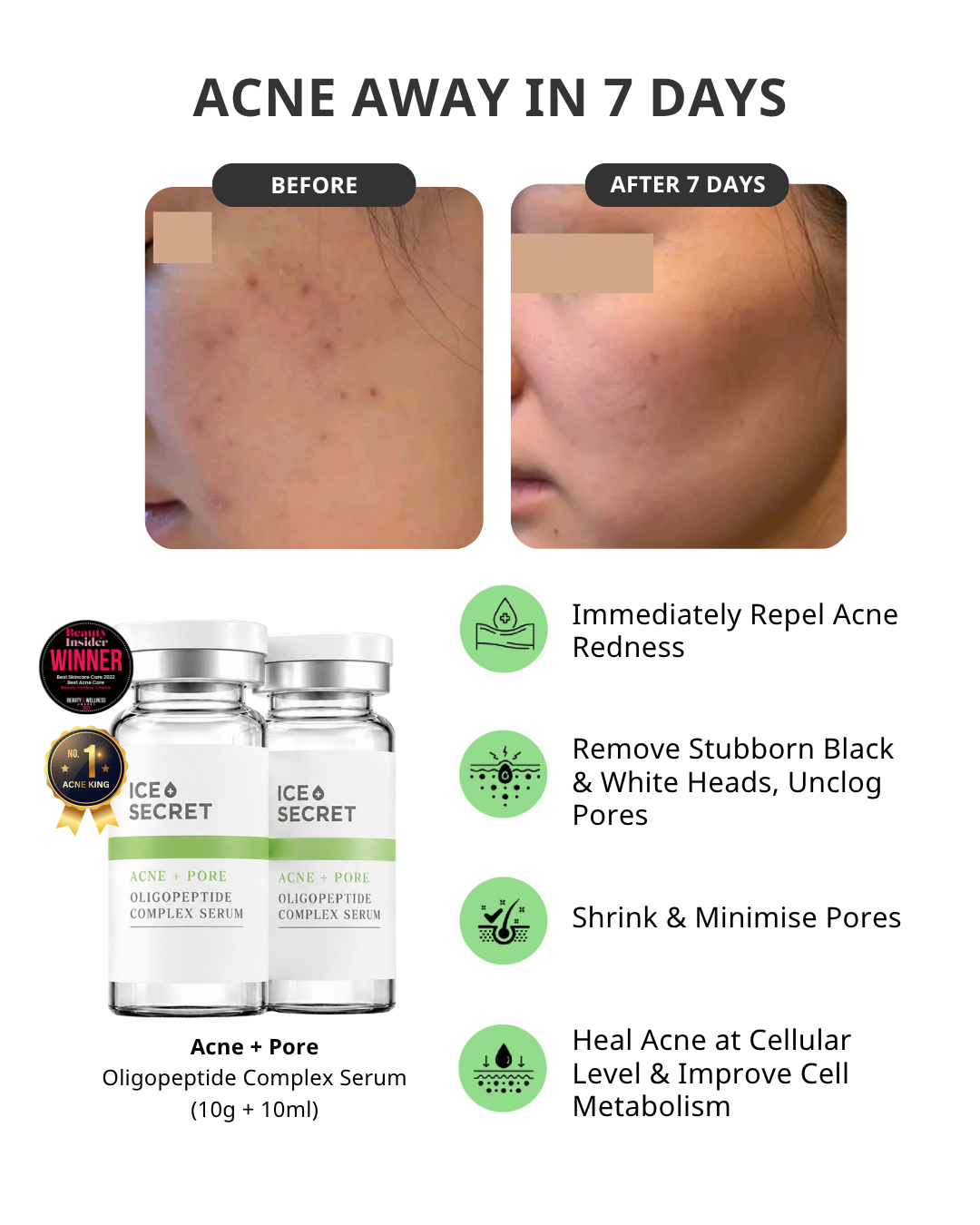 Acne & Pore Oligopeptide Complex Serum for Hormonal Acne