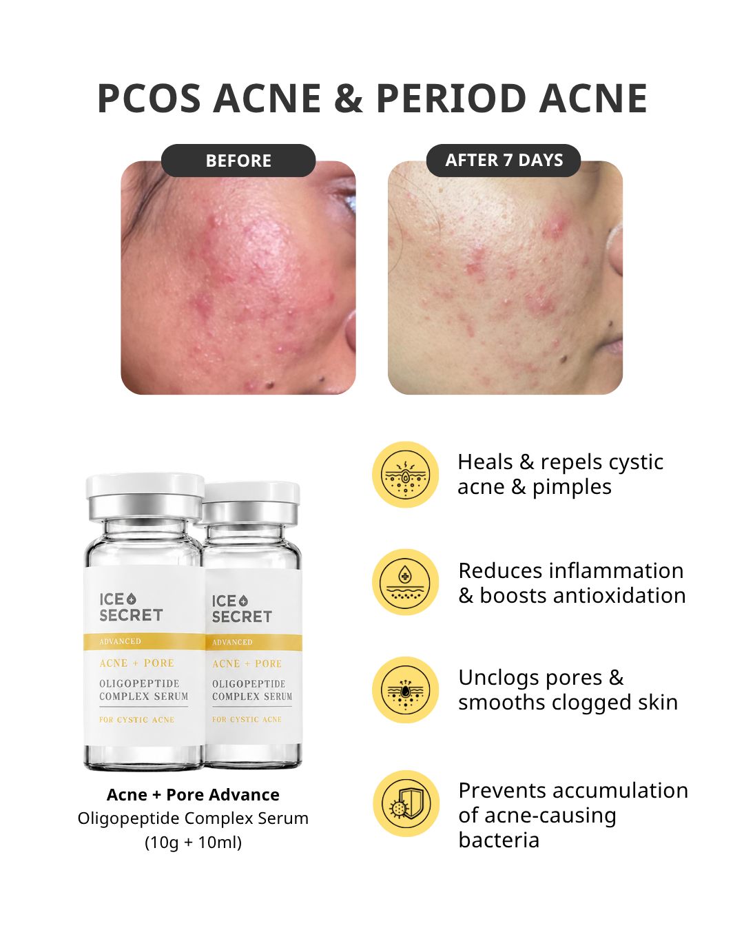 2_icesecret_infocard_acne_pore_ii_cystic_complex_serum.png