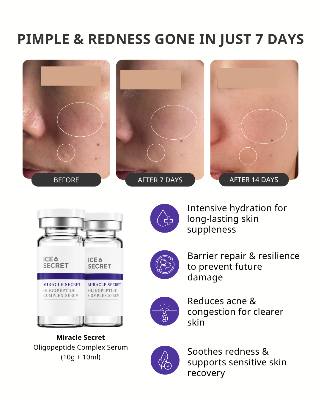 2_icesecret_infocard_miracle_secret_complex_serum.png