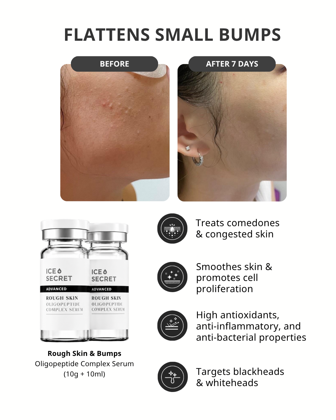 2_icesecret_infocard_rough_skin_complex_serum.png
