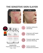 Sensitive & Redness Oligopeptide Complex Serum for sensitive skin