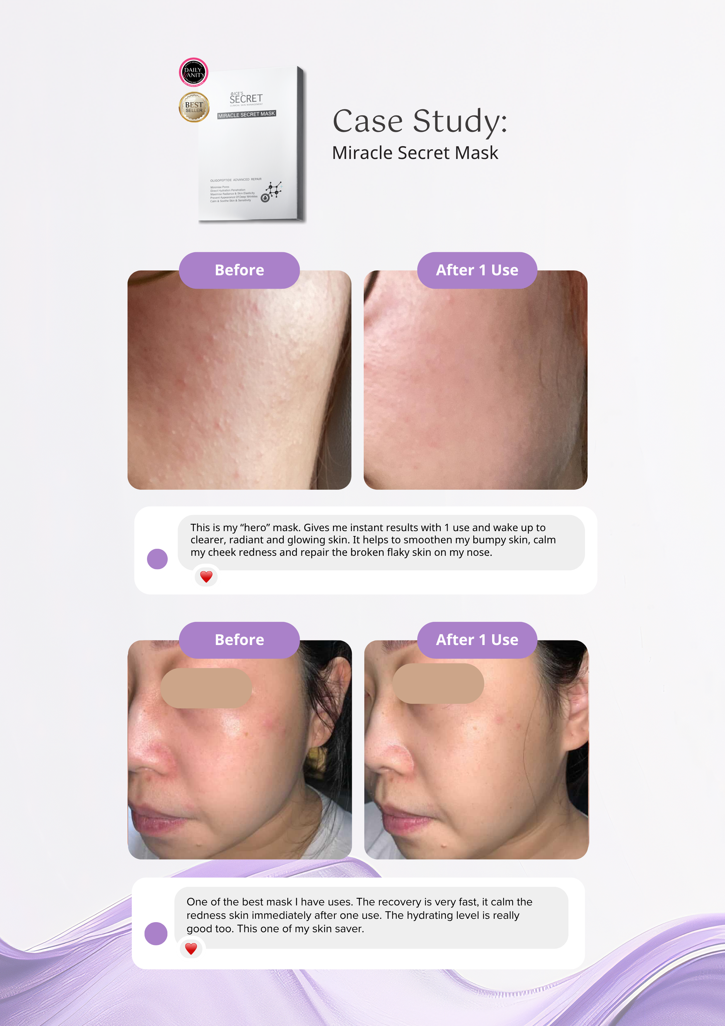 [Flash Deal] Miracle Secret Mask Bundle