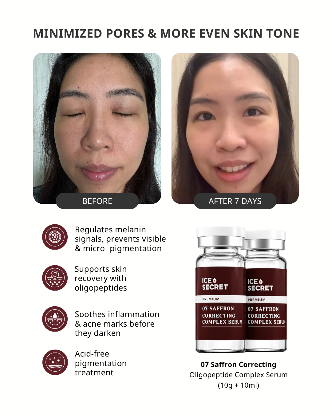 Pigmentation · 14-Day Change