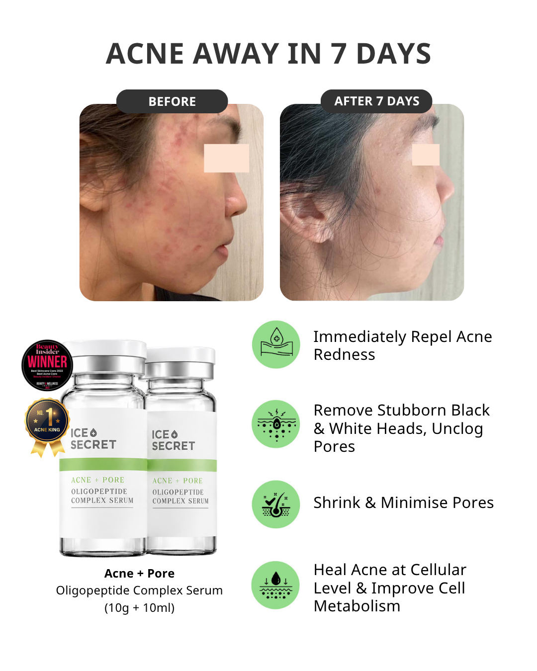 Acne & Pore Oligopeptide Complex Serum for Hormonal Acne
