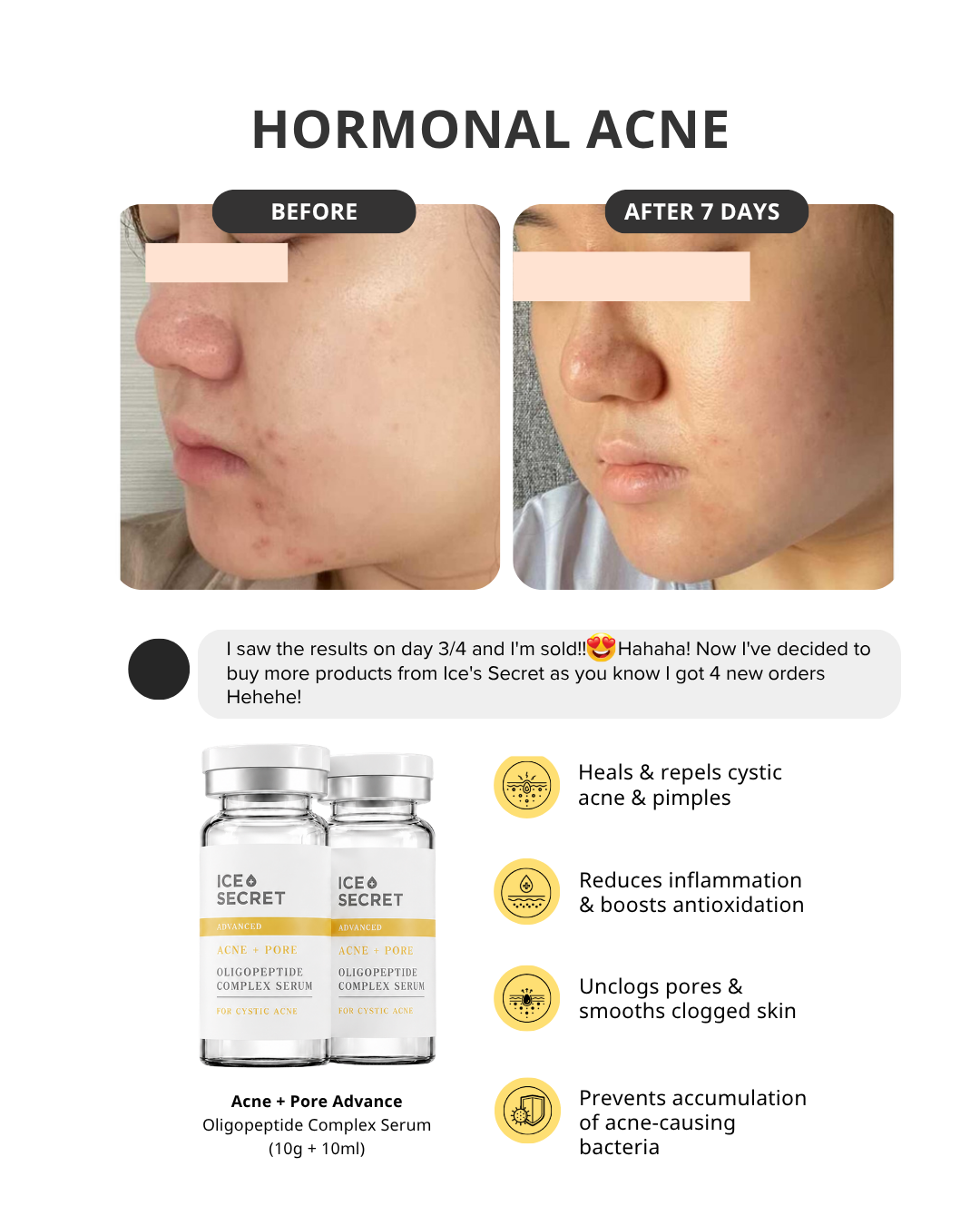 Acne + Pore II (For Cystic Acne) Advanced Oligopeptide Complex Serum